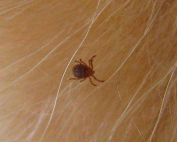 �}�_�j���o���B�N�X���܂��